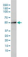 Anti-ACY1 Mouse Monoclonal Antibody [clone: 4F1-B7]