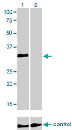 Anti-HOXC4 Mouse Monoclonal Antibody [clone: 1E9]