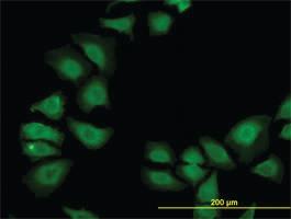 Anti-TXN Mouse Monoclonal Antibody [clone: 6C10]