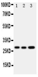 Anti-Oncostatin M Rabbit Polyclonal Antibody