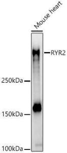 Anti-Ryanodine Receptor Antibody (A8382)