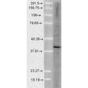 Anti-AHA1 antibody