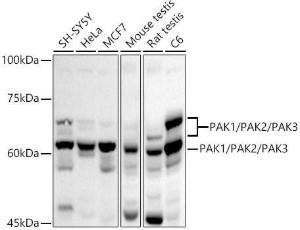 Anti-PAK1 + PAK2 + PAK3 Rabbit Polyclonal Antibody