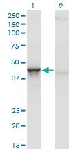 Anti-ACY1 Mouse Monoclonal Antibody [clone: 4F1-B7]