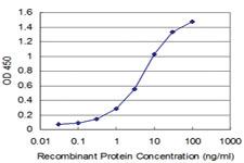 Anti-TXN Mouse Monoclonal Antibody [clone: 6C10]