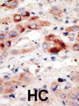 Anti-PI3KC3 Rabbit Polyclonal Antibody (APC (Allophycocyanin))