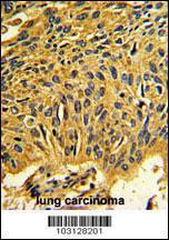 Anti-CDK2 Rabbit Polyclonal Antibody (FITC (Fluorescein Isothiocyanate))