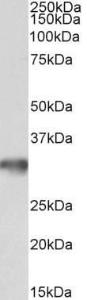 Anti-GOLPH3 Antibody (A84755) (0.1 µg/ml) staining of Mouse brain lysate (35 µg protein in RIPA buffer). Primary incubation was 1 hour. Detected by chemiluminescence