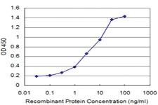 Anti-BRAF Mouse Monoclonal Antibody [clone: 2E9]