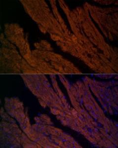 Immunofluorescence analysis of mouse heart cells using Anti-Ryanodine Receptor Antibody (A8382) at a dilution of 1:200 (40X lens). DAPI was used to stain the cell nuclei (blue)