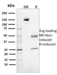 SDS-PAGE analysis of Anti-OGG1 Antibody [CPTC-OGG1-1] under non-reduced and reduced conditions; showing intact IgG and intact heavy and light chains, respectively. SDS-PAGE analysis confirms the integrity and purity of the antibody