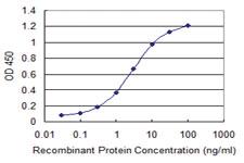 Anti-OTOP2 Mouse Monoclonal Antibody [clone: 6F11]