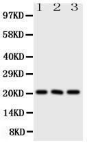 Anti-FGF21 Rabbit Polyclonal Antibody