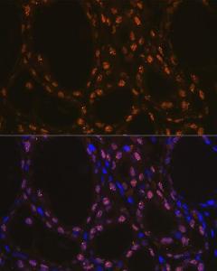 Anti-TTF1 Rabbit Monoclonal Antibody [clone: ARC1942]