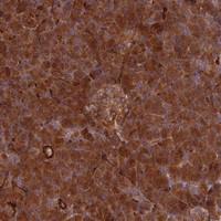 Anti-SPATS2 Rabbit Polyclonal Antibody