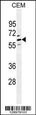 Anti-CLEC4F Rabbit Polyclonal Antibody (HRP (Horseradish Peroxidase))