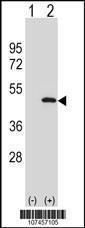 Anti-ATG3 Rabbit Polyclonal Antibody