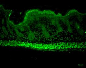 Anti-AHA1 antibody