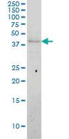 Anti-APOL3 Mouse Monoclonal Antibody [clone: 4E5]