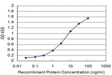 Anti-BRAF Mouse Monoclonal Antibody [clone: 2F7]