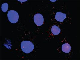 Anti-FLT1 + HCK Antibody Pair