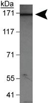 Anti-WHSC1L1 Rabbit Polyclonal Antibody