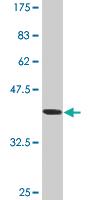 Anti-ATP2A1 Mouse Monoclonal Antibody [clone: 3H4]