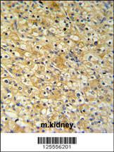 Anti-NAT8 Rabbit Polyclonal Antibody (PE (Phycoerythrin))