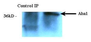 Anti-AHA1 antibody