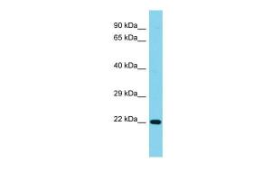 Anti-C1orf158 Rabbit Polyclonal Antibody