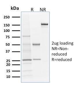 SDS-PAGE analysis of Anti-Langerin Antibody [LGRN/1821] under non-reduced and reduced conditions; showing intact IgG and intact heavy and light chains, respectively. SDS-PAGE analysis confirms the integrity and purity of the antibody