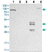 Anti-ESPN Rabbit Polyclonal Antibody