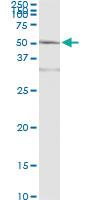 Anti-ACY1 Mouse Monoclonal Antibody [clone: 4F1-B7]