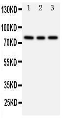 Anti-PI 3 Kinase p85 beta Rabbit Polyclonal Antibody