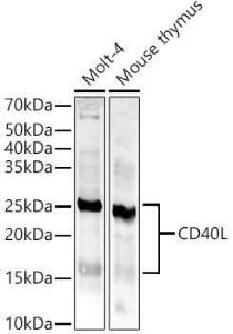 Anti-TNFSF5 Antibody (A8386)