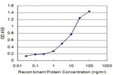 Anti-BRAF Mouse Monoclonal Antibody [clone: 1F2]