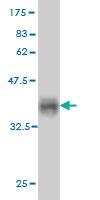 Anti-ATP2A1 Mouse Monoclonal Antibody [clone: 5G4]