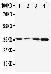 Anti-Protein C Rabbit Polyclonal Antibody