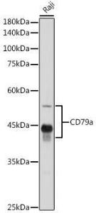 Anti-CD79a Antibody (A8388)