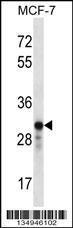 Anti-GRAP2 Rabbit Polyclonal Antibody (AP (Alkaline Phosphatase))