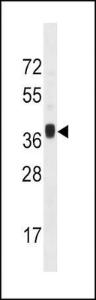 Anti-MNX1 Rabbit Polyclonal Antibody (AP (Alkaline Phosphatase))