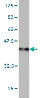 Anti-USP4 Mouse Monoclonal Antibody [clone: 5E12]