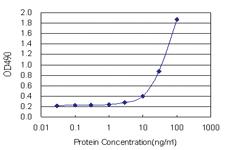 Anti-AHCY Polyclonal Antibody Pair