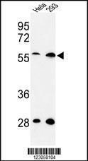 Anti-SKA3 Rabbit Polyclonal Antibody (Biotin)