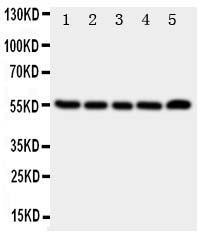 Anti-Neurokinin 1 Receptor Rabbit Polyclonal Antibody