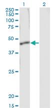 Anti-SERPINB1 Mouse Monoclonal Antibody [clone: 4A7]