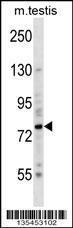 Anti-BRSK2 Rabbit Polyclonal Antibody (FITC (Fluorescein Isothiocyanate))