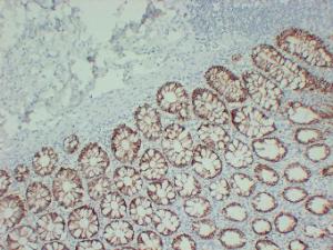 Immunohistochemical analysis of paraffin-embedded human Colon using Anti-TGF beta Receptor I Antibody