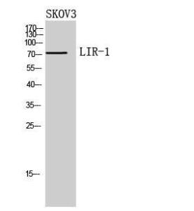 Western blot analysis of SKOV3 cells using Anti-LILRB1 Antibody