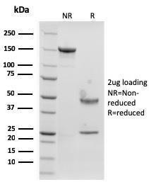 SDS-PAGE analysis of Anti-Langerin Antibody [rLGRN/1821] under non-reduced and reduced conditions; showing intact IgG and intact heavy and light chains, respectively. SDS-PAGE analysis confirms the integrity and purity of the Antibody